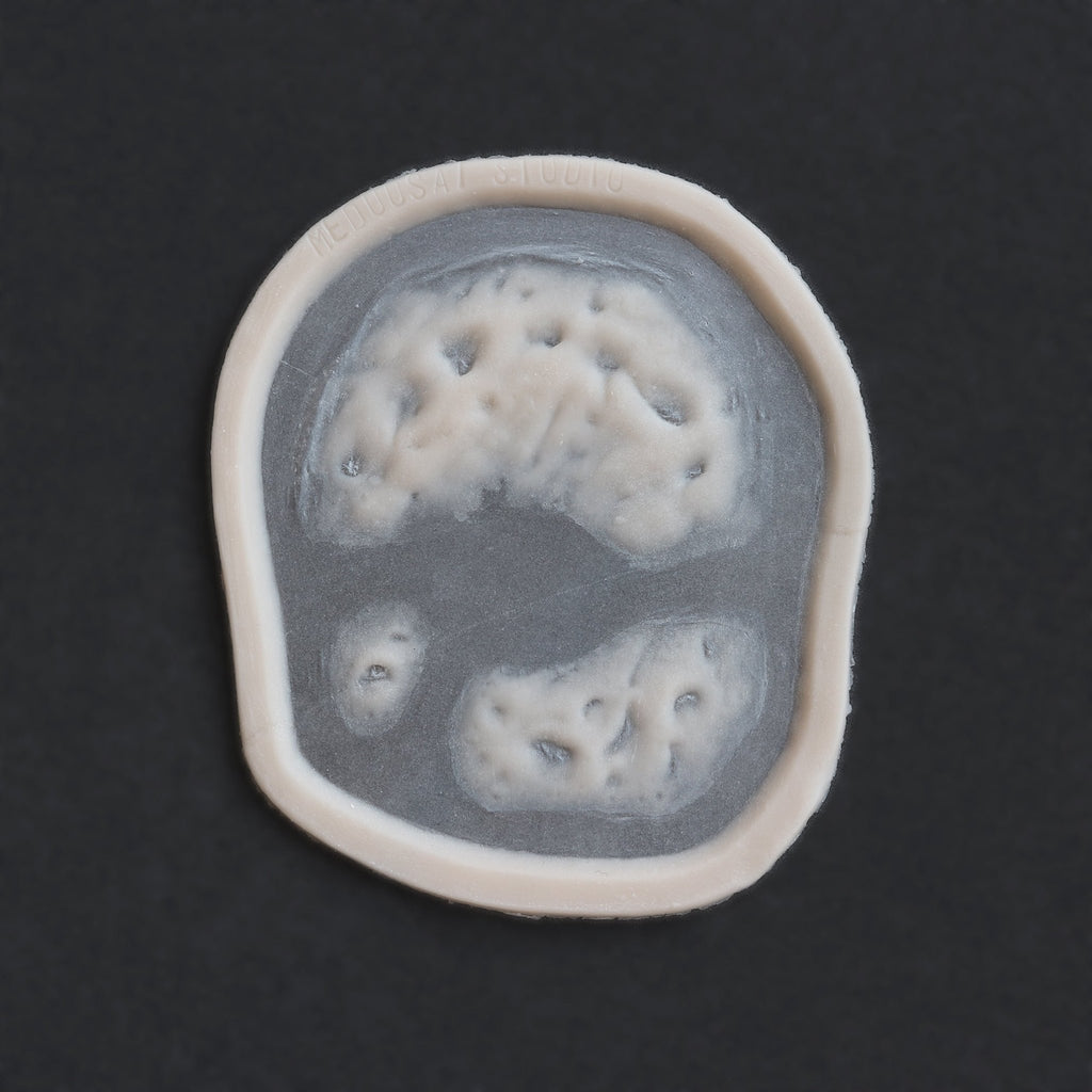 Zombie Bite 2.0 - Silicone makeup prosthetic in vanilla shade on a black surface